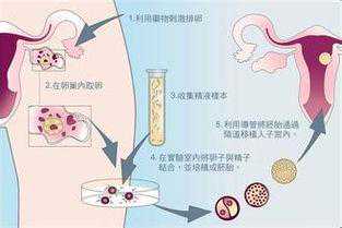 香港验血要怀孕几周可以,什么是试管婴儿，哪些情况需做试管婴儿你知道吗？